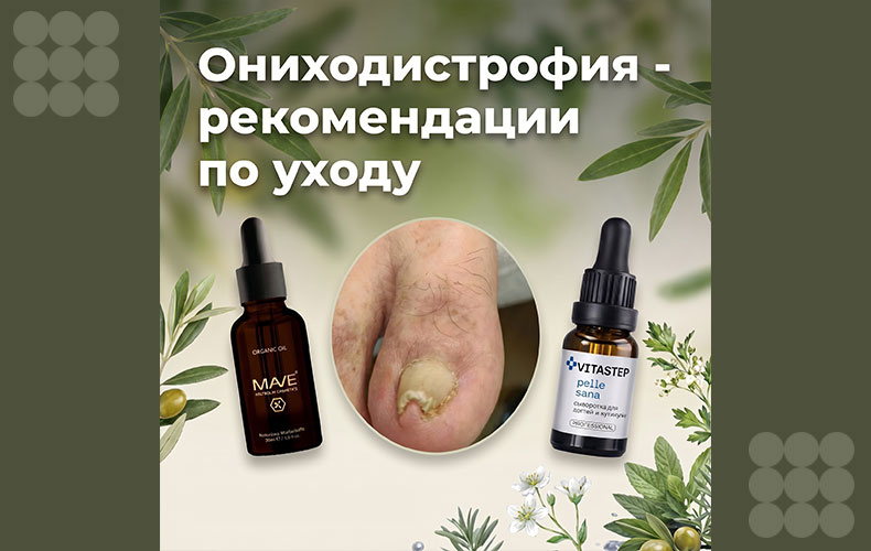 Ониходистрофия: как отличить от грибка и восстановить ногти