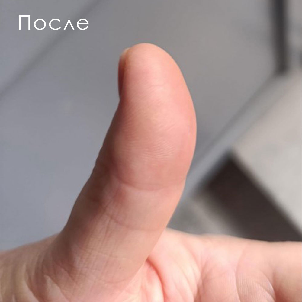 Бальзам для кожи ног Verrugal Oil, 15мл - 4